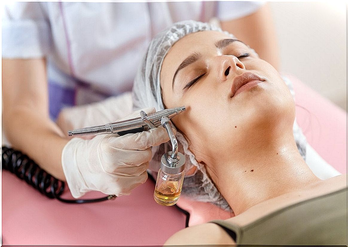 Chemical peel: what are the acids used?