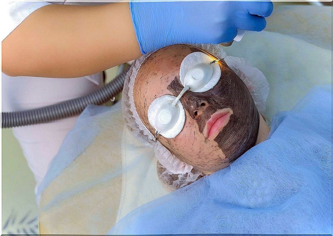 facial peeling