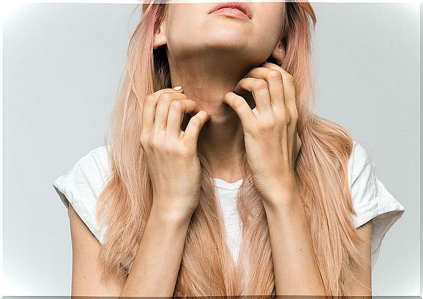 Woman scratching her neck from allergy