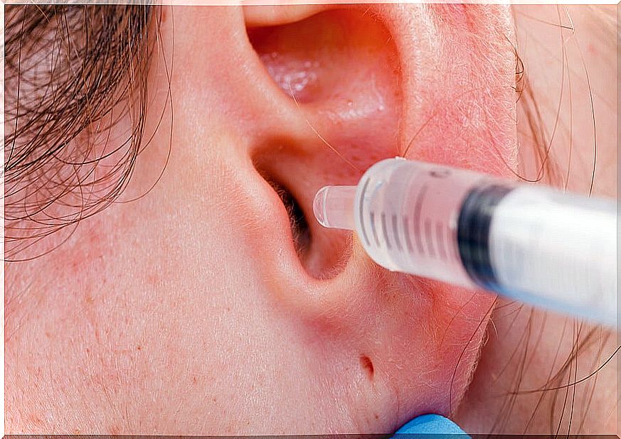 How To Remove Excess Ear Wax Naturally