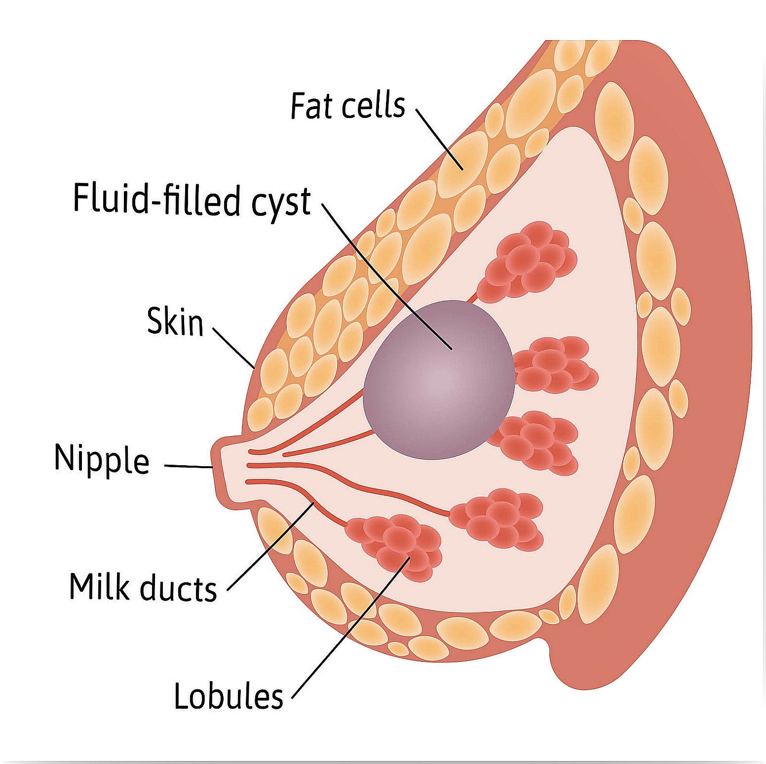 Breast cysts