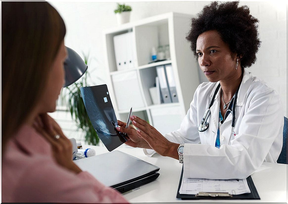 Doctor shows a mammogram.