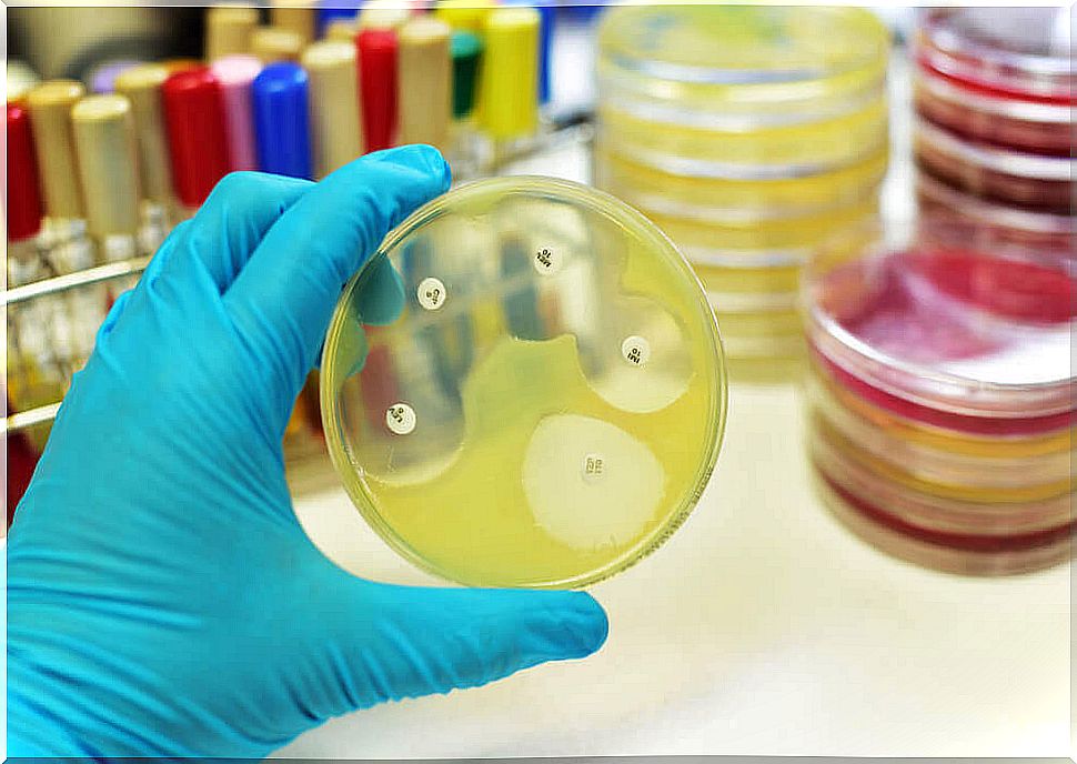 Petri dish antibiogram