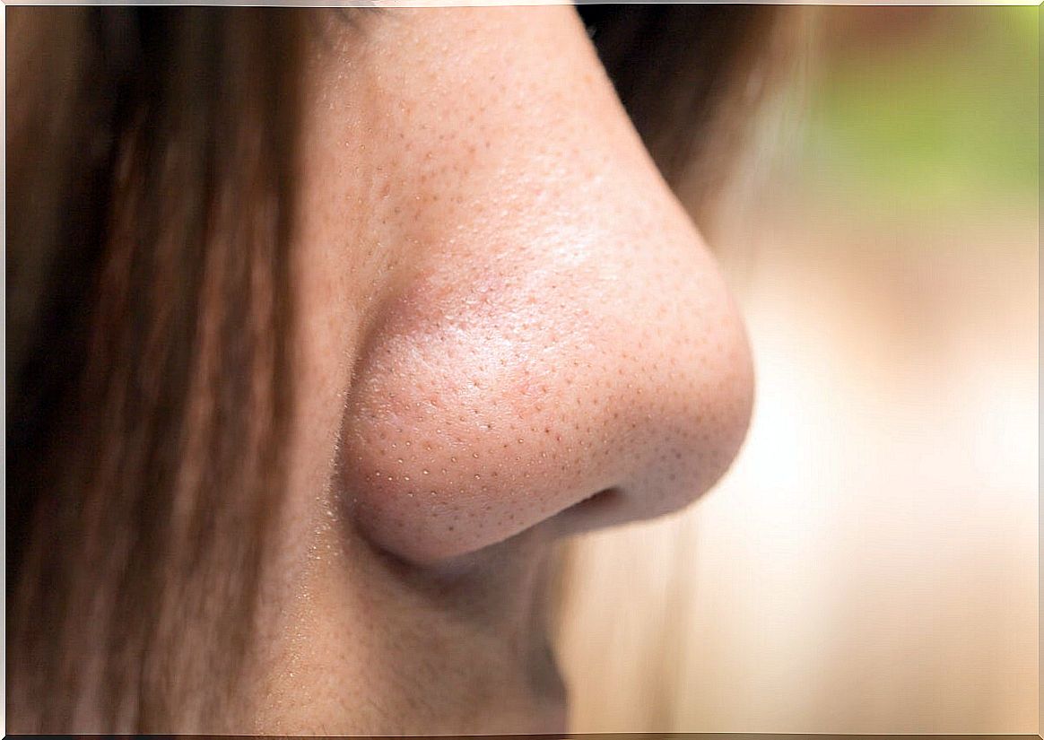 Nose of a woman suffering from phantosmia.