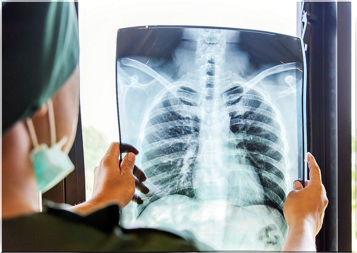 X-ray of the lungs.