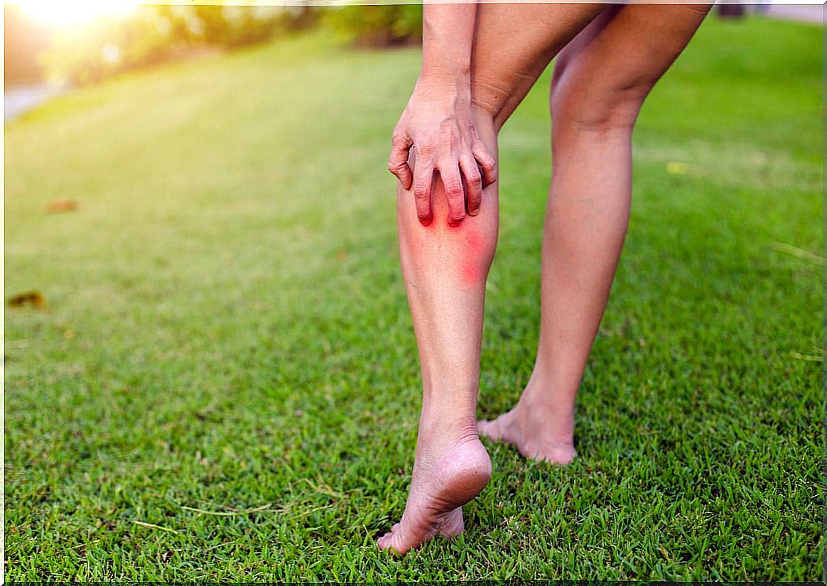 Scratching of the leg in a woman.