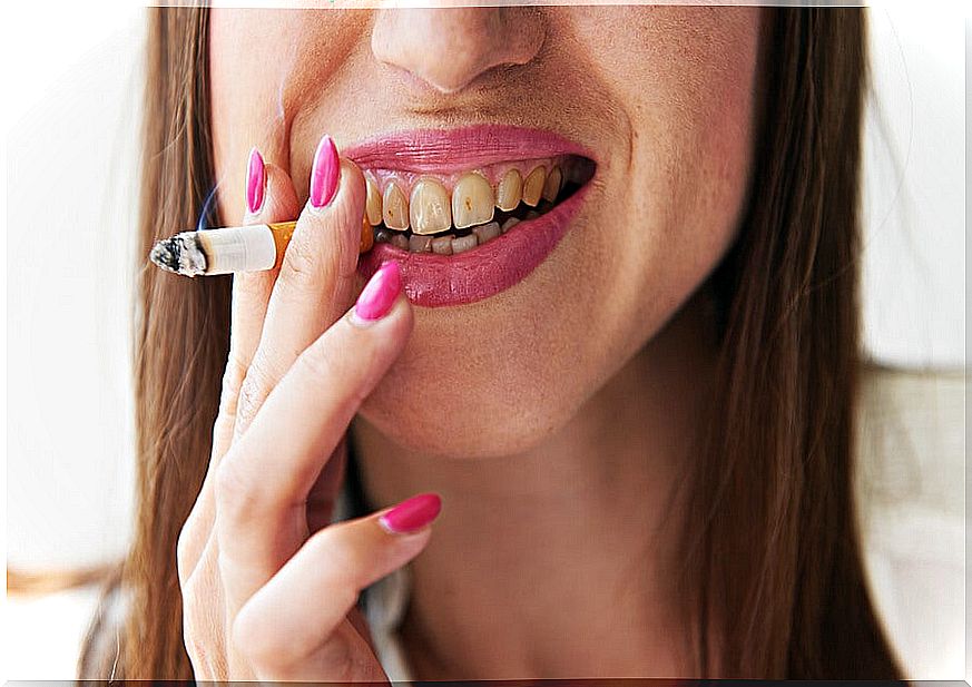 Woman revealing the damage of tobacco in the oral cavity