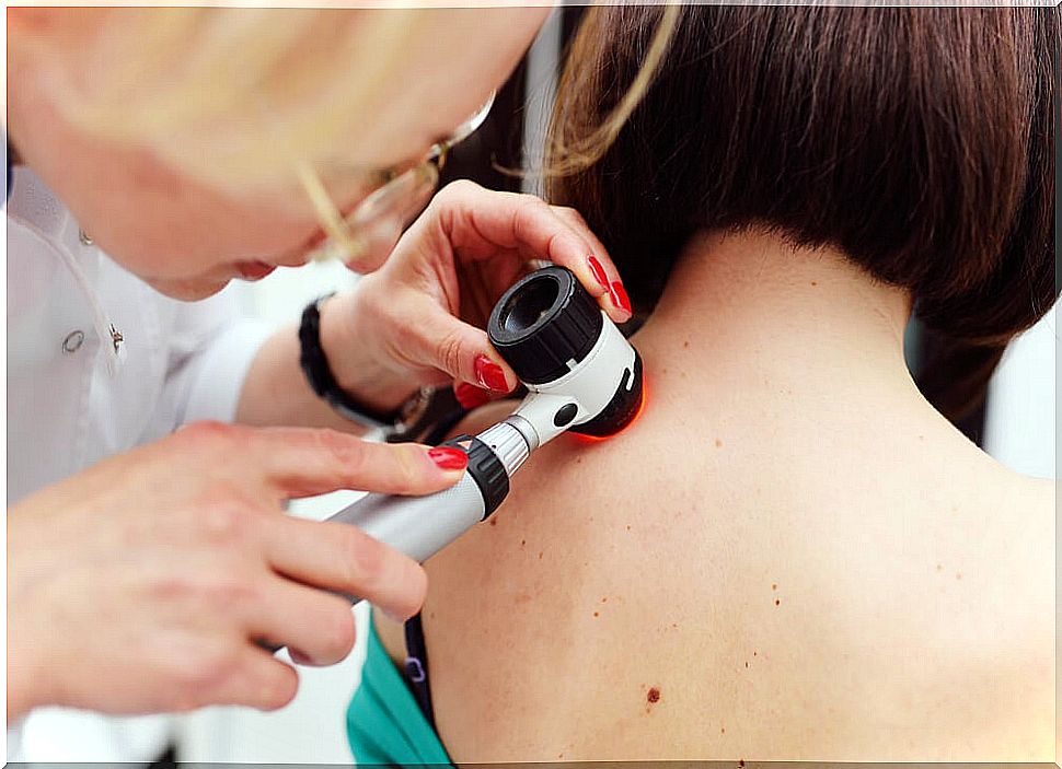 Melanoma is the only serious type of skin cancer