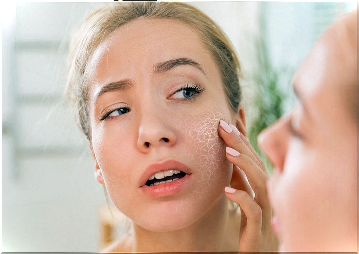 What are the causes of dry skin?