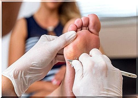 Woman with corns on her feet